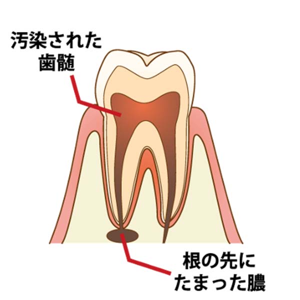 レントゲン撮影